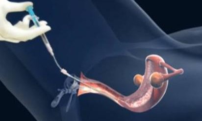 2026河南省妇幼保健院试管婴儿费用一览，附试管医生推荐